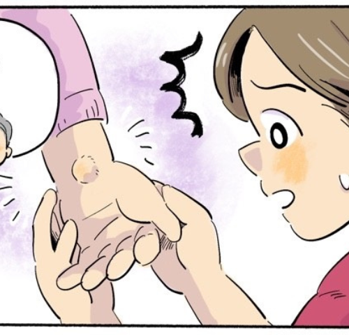 「手に大きなコブが…」 手を引いたときに触れた固まり。祖母の手に隠れていた物体の正体は【体験談】